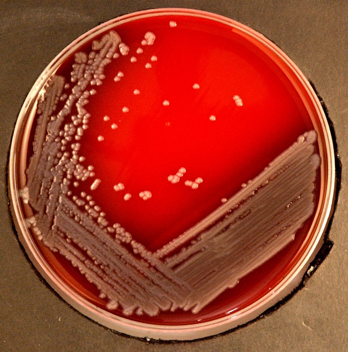 محیط کشت عمومی