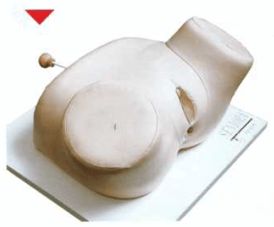 مولاژ معاینه اندام تناسلی زن