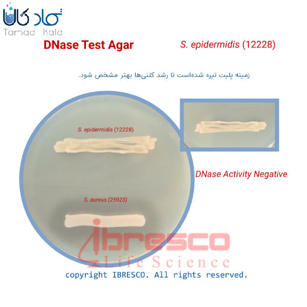 محیط کشت دی ان ایز تست آگار ایبرسکو