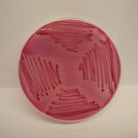 محیط کشت اندو