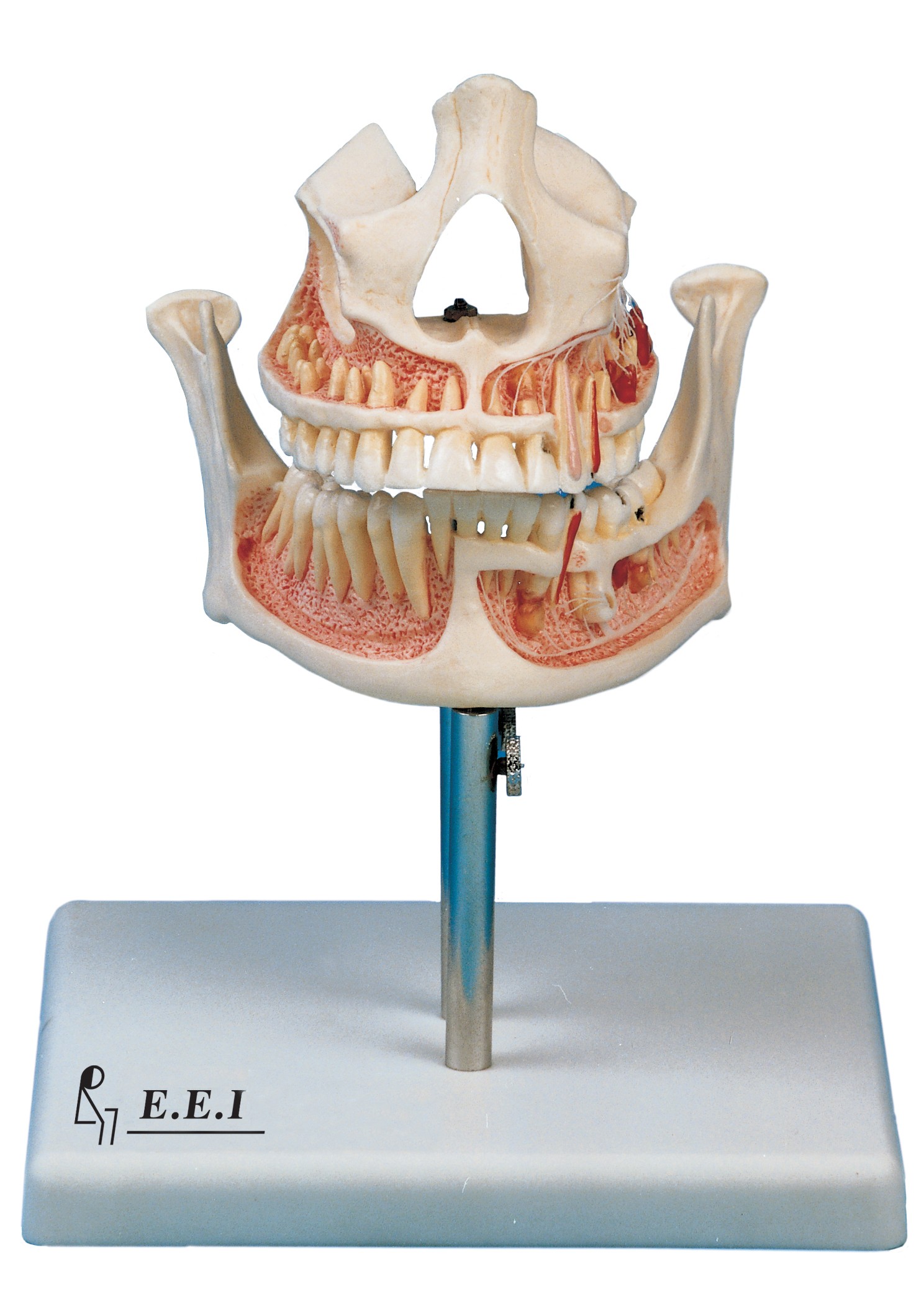مولاژ فک بالا و پایین