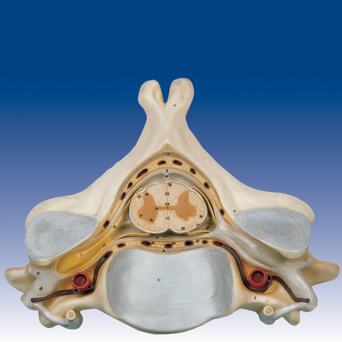مولاژ پنجمین مهره گردن