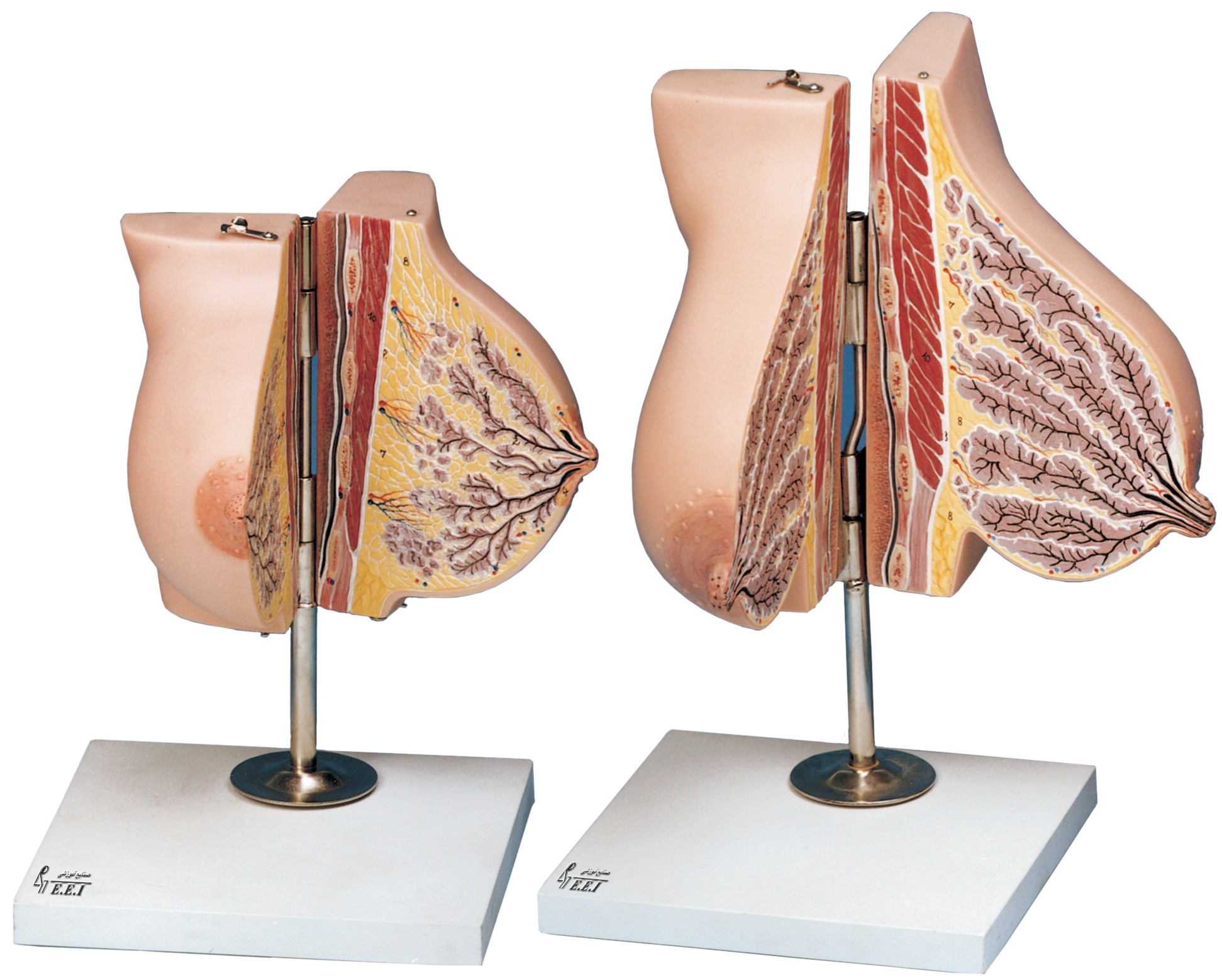 مولاژ غدد پستان