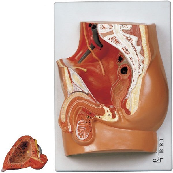 مولاژ مقطع لگن خاصره مرد