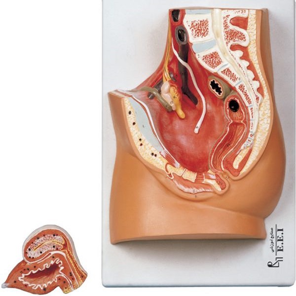 مولاژ مقطع لگن خاصره زن