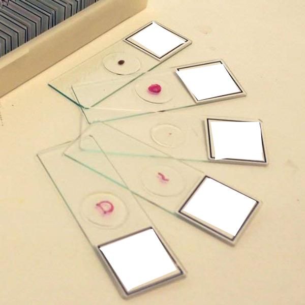 خرید لام میکروسکوپی سلول های خونی (آموزشی)