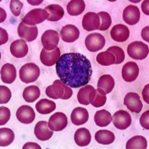 خرید لام میکروسکوپی سلول های خونی (آموزشی)