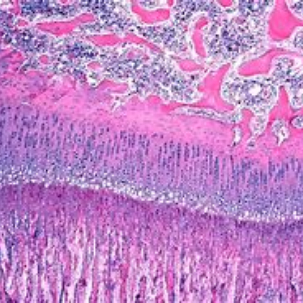 لام میکروسکوپی صفحه رشد استخوانی (آموزشی)