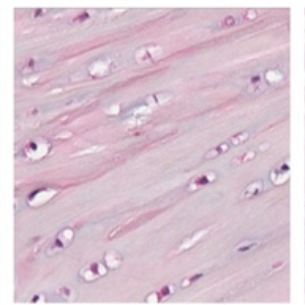 لام میکروسکوپی غضروف فیبری (آموزشی)