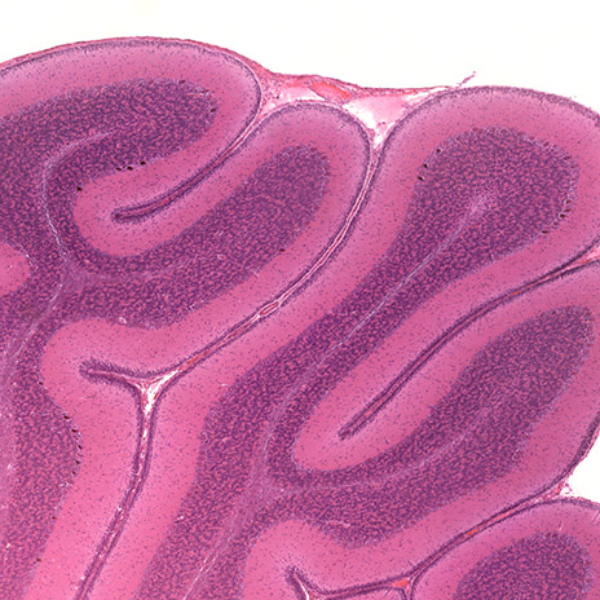 لام میکروسکوپی مخچه (آموزشی)