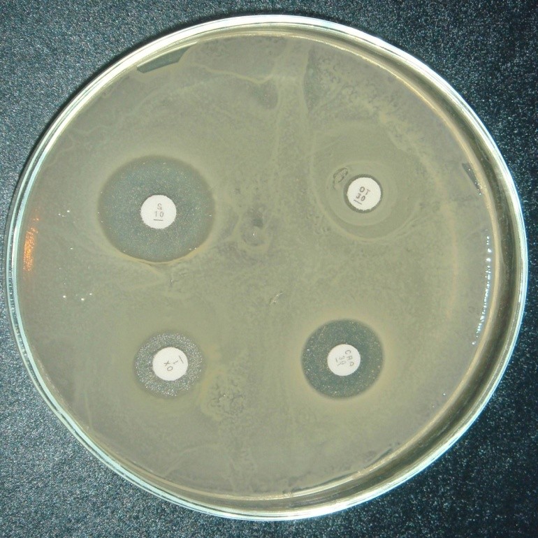 muller hinton agar