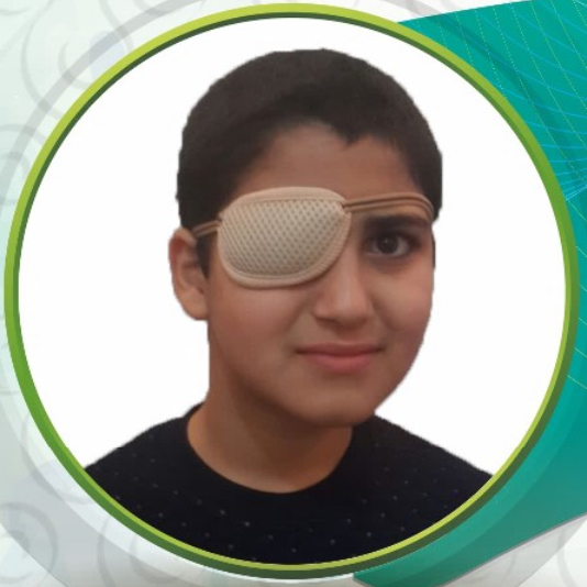 پد تنبلی چشم سما طب