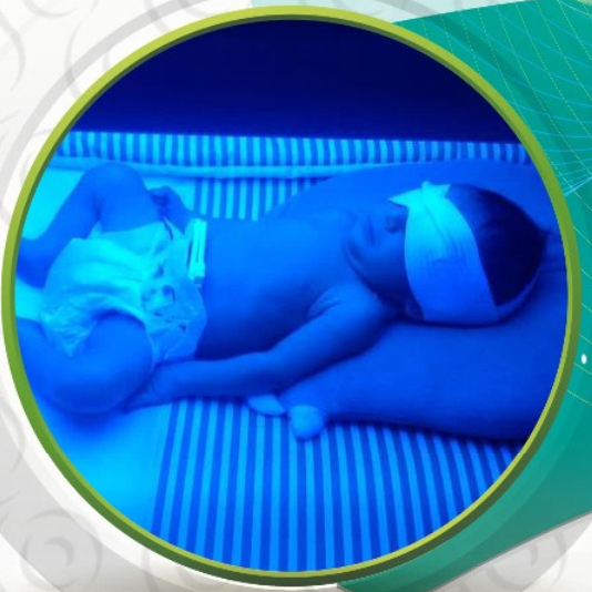 شورت فوتوتراپی سما طب