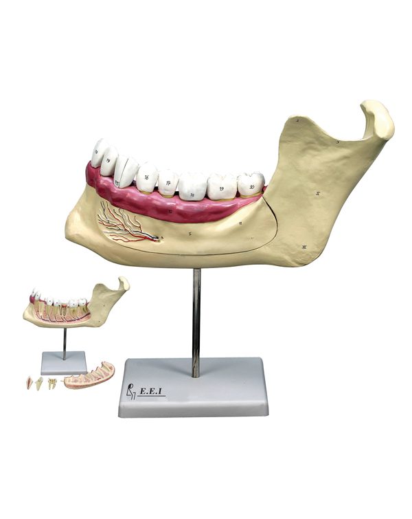 مولاژ آرواره پایین
