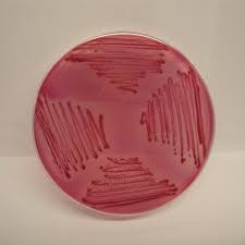 محیط کشت اندو آگار بیس