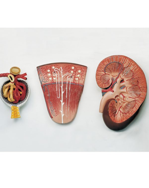 مولاژ کلیه سه تکه