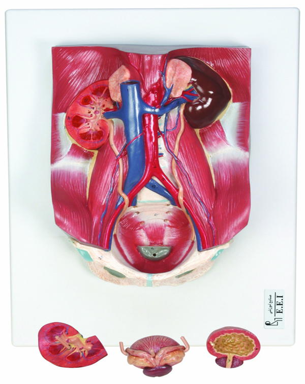 مولاژ دستگاه ادراری، چهارتکه