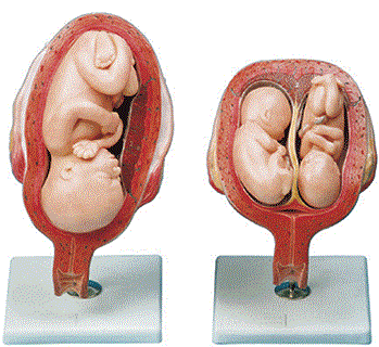 مولاژ مراحل حاملگی