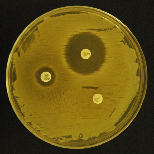 سویه استافیلو کوکوس اریوس