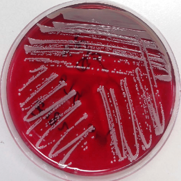 خرید سویه استافیلو کوکوس اریوس کد ATCC6538