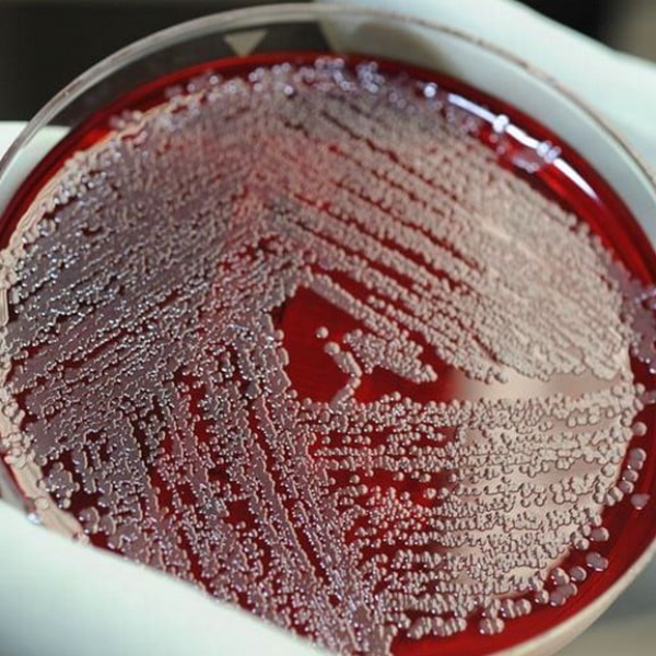 خرید سویه سودوموناس آئروژینوزا کد ATCC9027