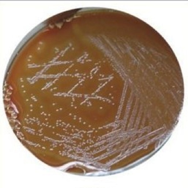 محیط کشت جی سی آگار بیس