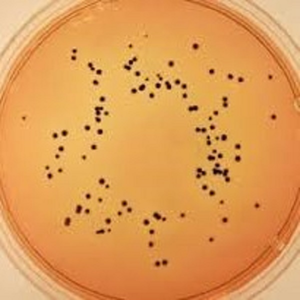 محیط کشت هکتون انتریک آگار گرید detection and isolation کد 111681 مرک