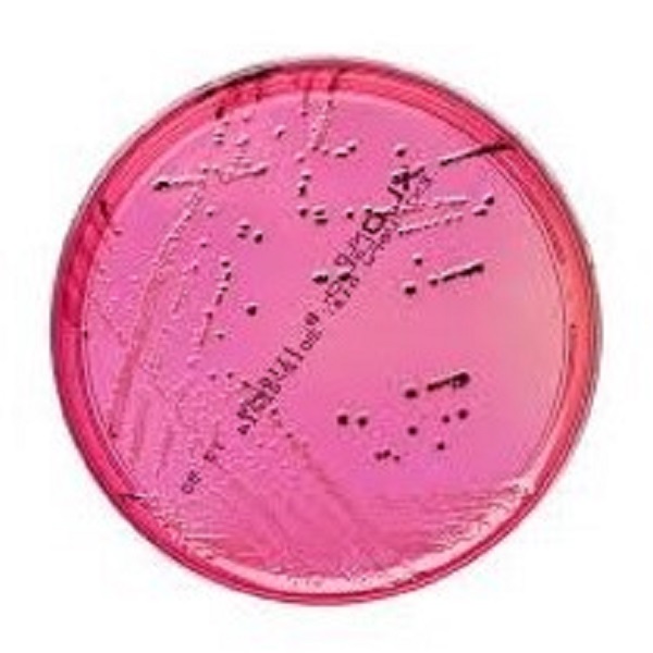 محیط کشت XLD آگار