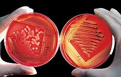 What is blood agar culture medium?