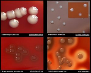 Introduction of blood agar culture medium