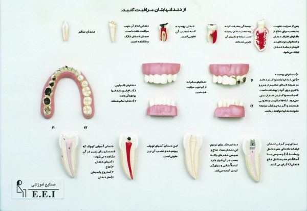مراقب دندان