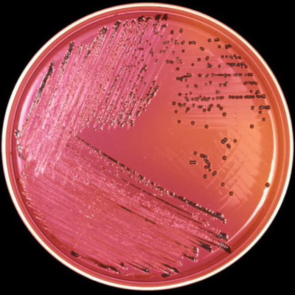 Salmonella enterica subsp. enterica serovar Typhimurium ATCC 14028